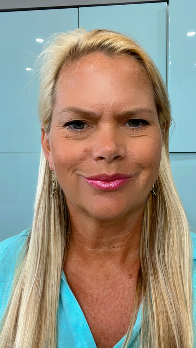 Big Gator Earrings - Image 4